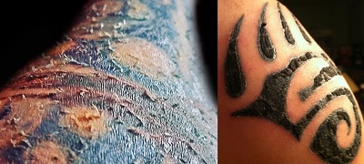tattoo-aftercare-scabbing-and-peeling